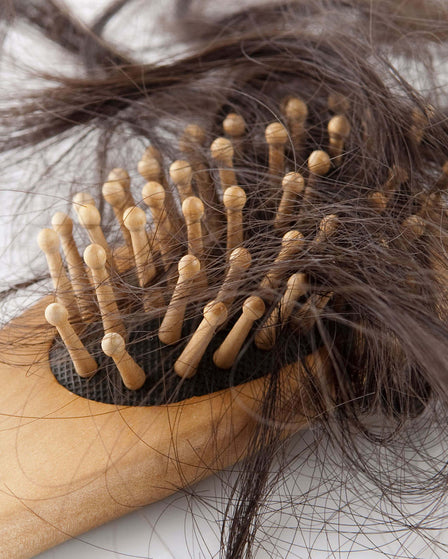 5 Home Remedies for Hair Fall After Pregnancy