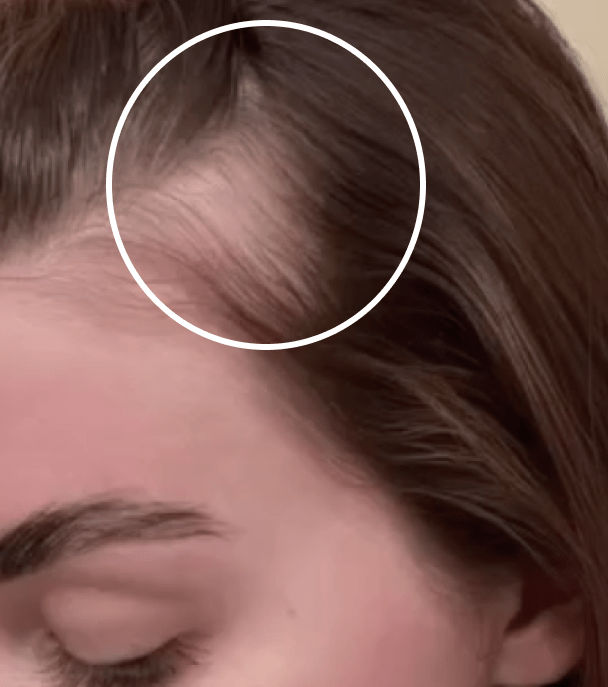 Unlocking the Secrets: Finding the Best Hair Product for Thin Hair